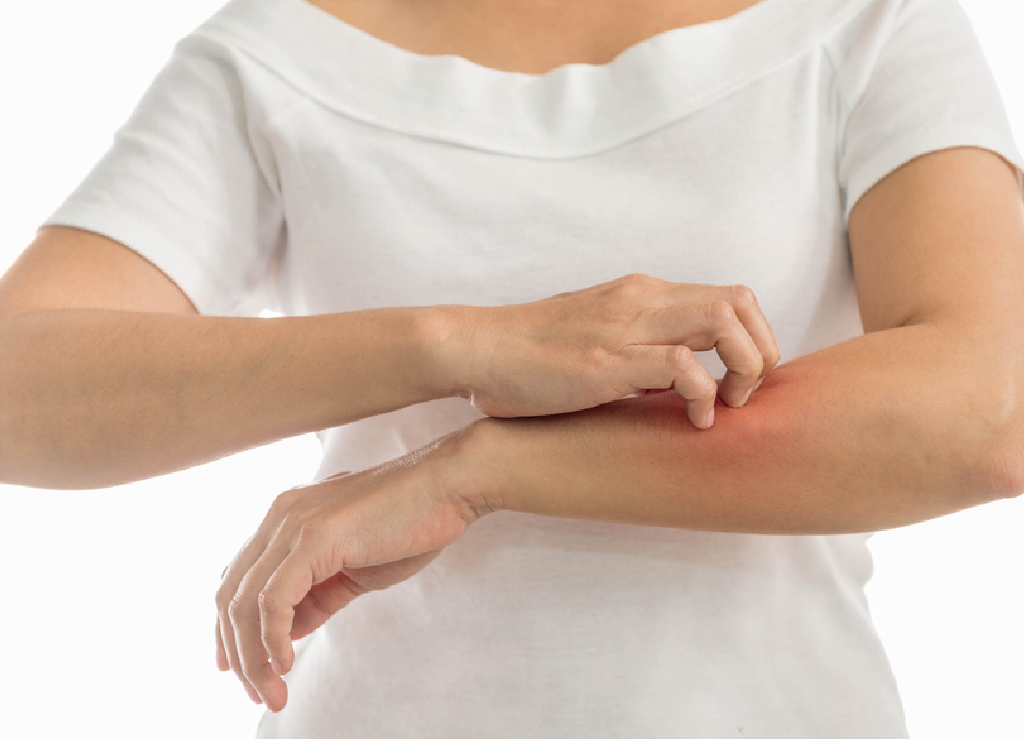 湿疹はどれくらい一般的ですか?